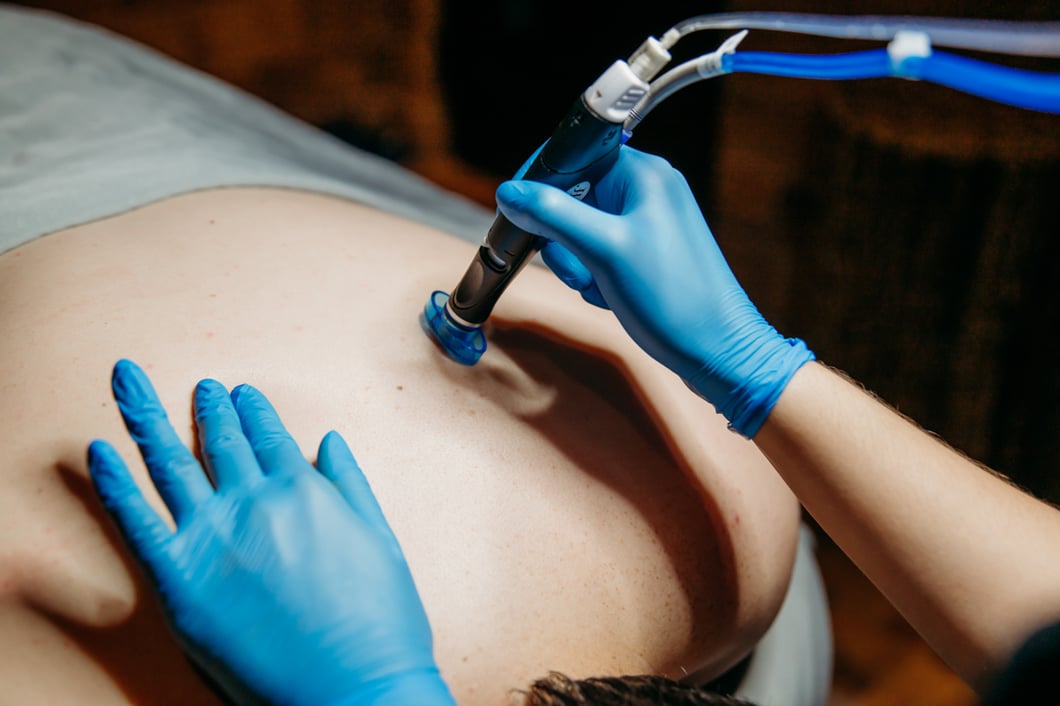 HydraFacial Back treatment at the Spa at Bella Collina