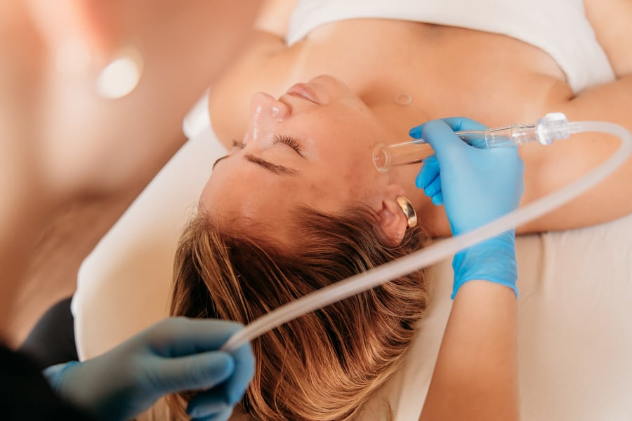 Why HydraFacial is the Ultimate Skincare Treatment