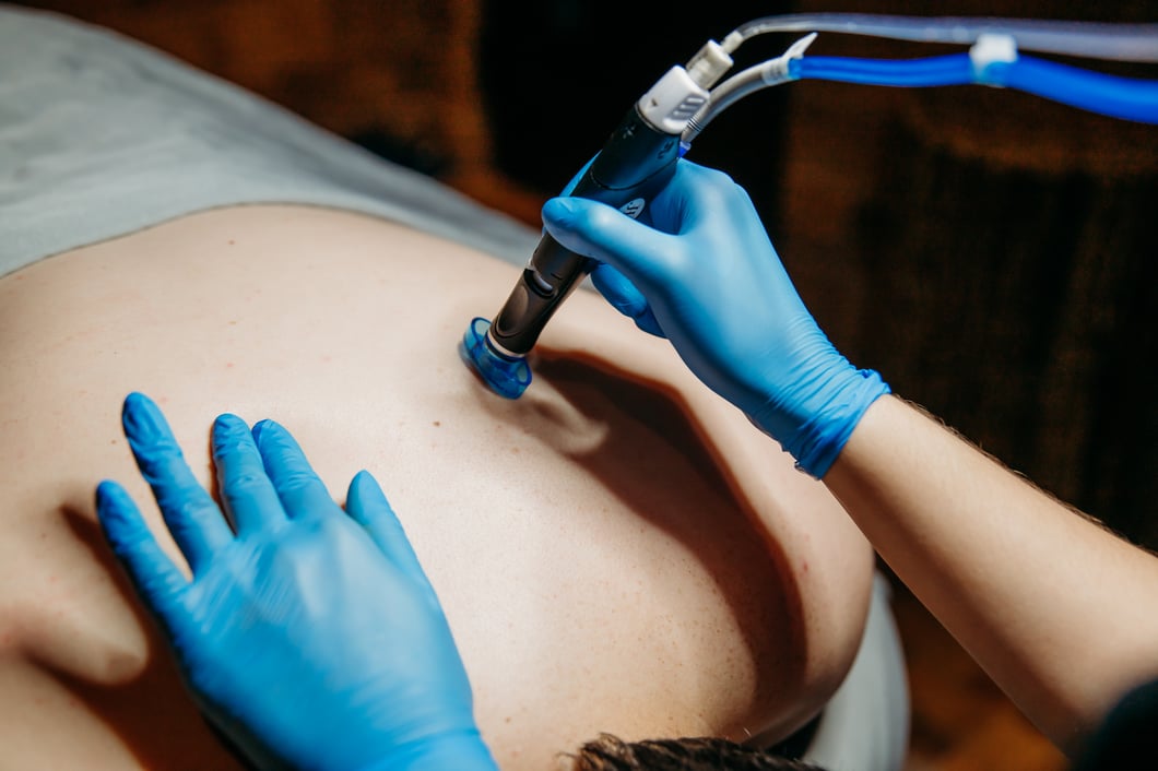 HydraFacial Back3